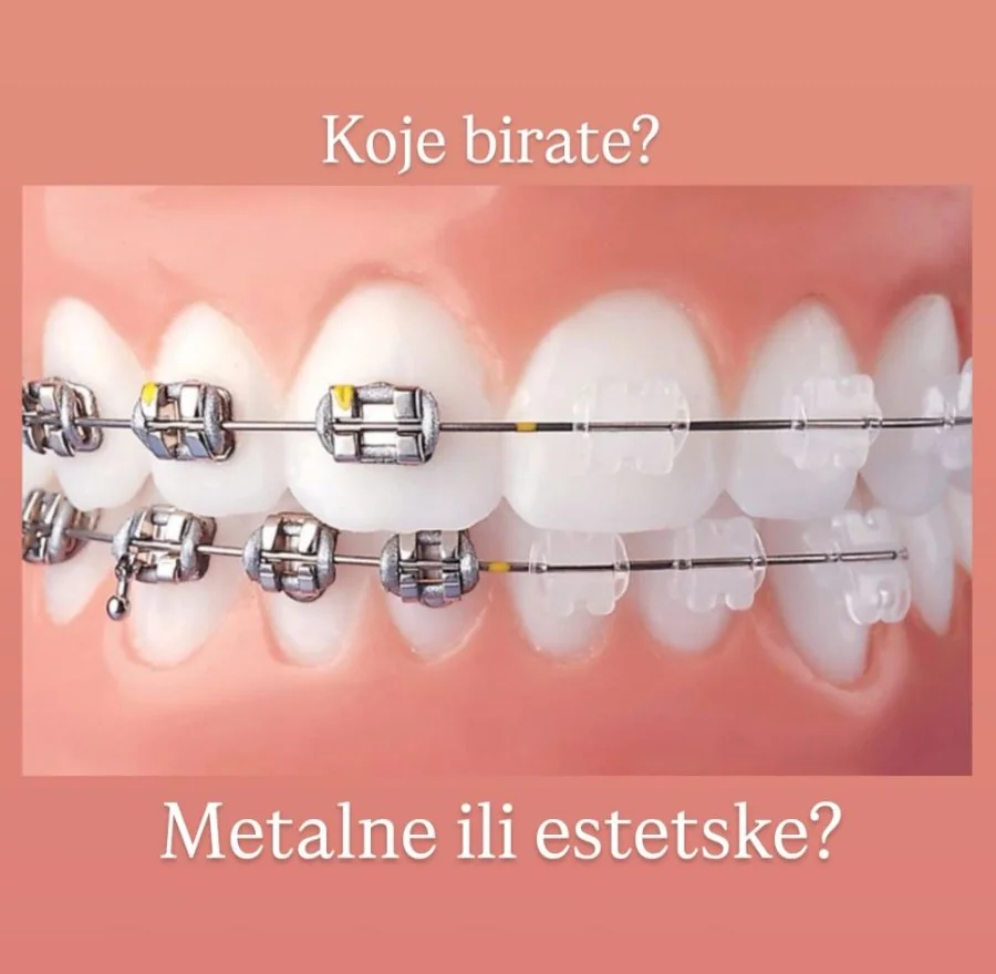 Ortodoncija